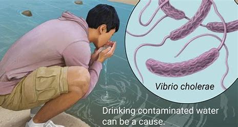 Cholera